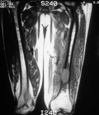 Basic Science Board Review 2002: High-Yield MCQs (Set 4) - Figure 32