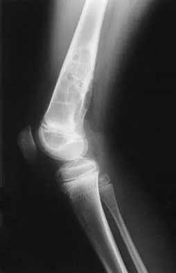 Basic Science 2005 Practice Questions: Set 1 (Solved) - Figure 14
