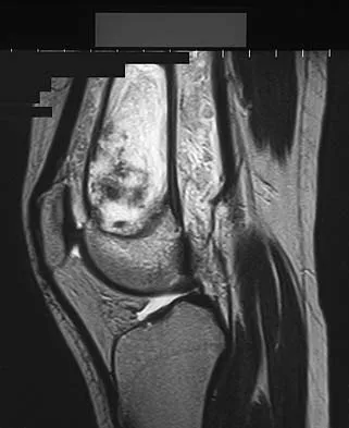 Basic Science 2005 Practice Questions: Set 1 (Solved) - Figure 17
