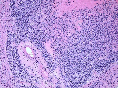 Basic Science 2005 Practice Questions: Set 1 (Solved) - Figure 18