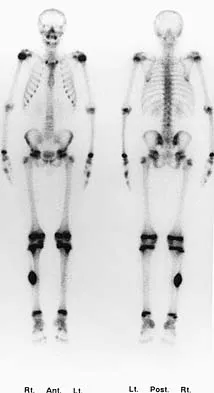 Basic Science 2005 Practice Questions: Set 1 (Solved) - Figure 2