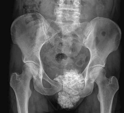 Basic Science 2005 Practice Questions: Set 1 (Solved) - Figure 20