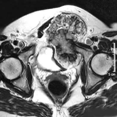 Basic Science 2005 Practice Questions: Set 1 (Solved) - Figure 22