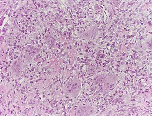 Basic Science 2005 Practice Questions: Set 1 (Solved) - Figure 26
