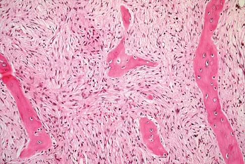 Basic Science 2005 Practice Questions: Set 1 (Solved) - Figure 3