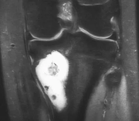 Basic Science 2005 Practice Questions: Set 1 (Solved) - Figure 32