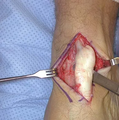 Basic Science 2005 Practice Questions: Set 1 (Solved) - Figure 40