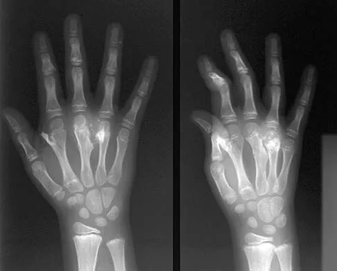 Basic Science 2005 Practice Questions: Set 1 (Solved) - Figure 50