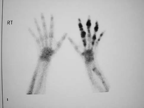 Basic Science 2005 Practice Questions: Set 1 (Solved) - Figure 56