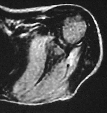 Basic Science Board Review 2005: High-Yield MCQs (Set 2) - Figure 11