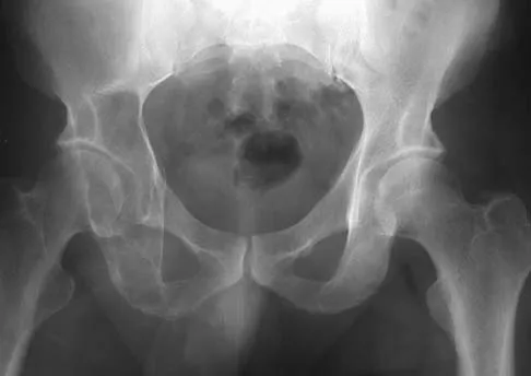 Basic Science Board Review 2005: High-Yield MCQs (Set 2) - Figure 12