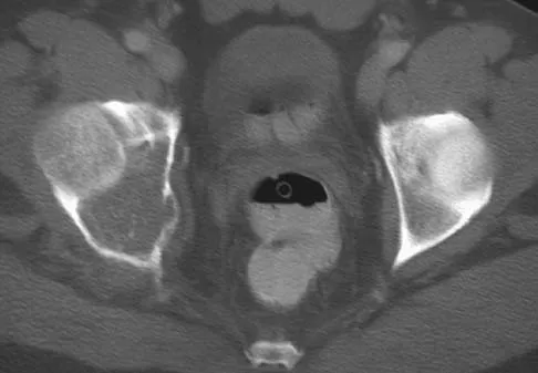 Basic Science Board Review 2005: High-Yield MCQs (Set 2) - Figure 13