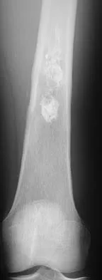 Basic Science Board Review 2005: High-Yield MCQs (Set 2) - Figure 16