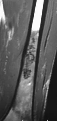 Basic Science Board Review 2005: High-Yield MCQs (Set 2) - Figure 17