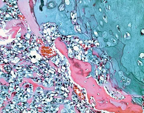 Basic Science Board Review 2005: High-Yield MCQs (Set 2) - Figure 18