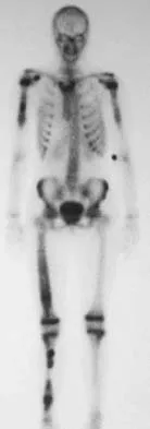 Basic Science Board Review 2005: High-Yield MCQs (Set 2) - Figure 20