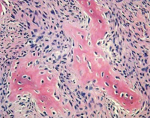 Basic Science Board Review 2005: High-Yield MCQs (Set 2) - Figure 22