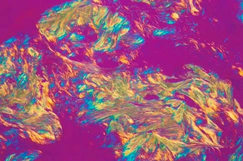 Basic Science Board Review 2005: High-Yield MCQs (Set 2) - Figure 28