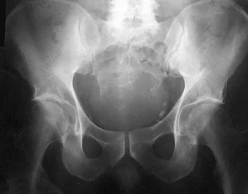 Basic Science Board Review 2005: High-Yield MCQs (Set 2) - Figure 30