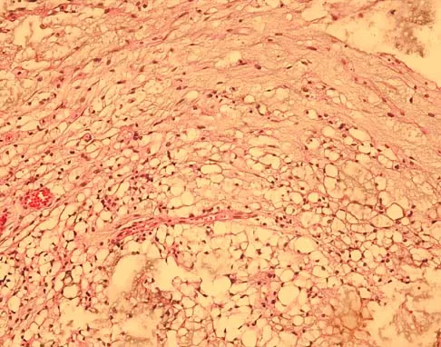 Basic Science Board Review 2005: High-Yield MCQs (Set 2) - Figure 33