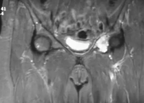 Basic Science Board Review 2005: High-Yield MCQs (Set 2) - Figure 4