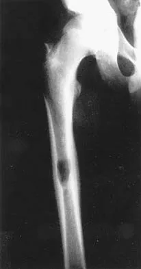 Basic Science Board Review 2005: High-Yield MCQs (Set 2) - Figure 42