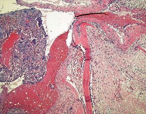 Basic Science Board Review 2005: High-Yield MCQs (Set 2) - Figure 46