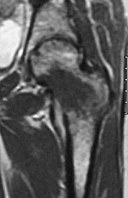 Basic Science Board Review 2005: High-Yield MCQs (Set 2) - Figure 49