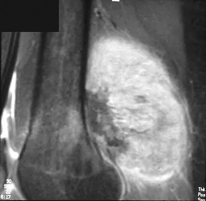 Basic Science 2005 Practice Questions: Set 3 (Solved) - Figure 14