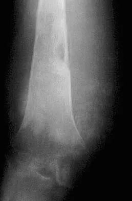 Basic Science 2005 Practice Questions: Set 3 (Solved) - Figure 2