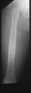 Basic Science 2005 Practice Questions: Set 3 (Solved) - Figure 24