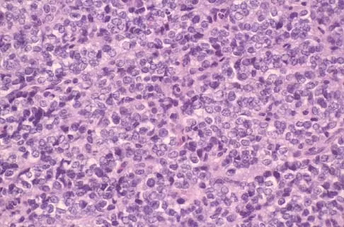 Basic Science 2005 Practice Questions: Set 3 (Solved) - Figure 27