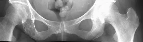 Basic Science 2005 Practice Questions: Set 3 (Solved) - Figure 28