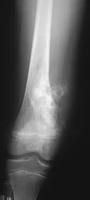 Basic Science 2005 Practice Questions: Set 3 (Solved) - Figure 31