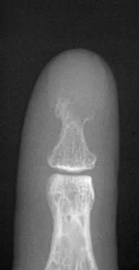 Basic Science 2005 Practice Questions: Set 3 (Solved) - Figure 33
