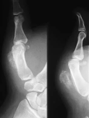 Basic Science 2005 Practice Questions: Set 3 (Solved) - Figure 5