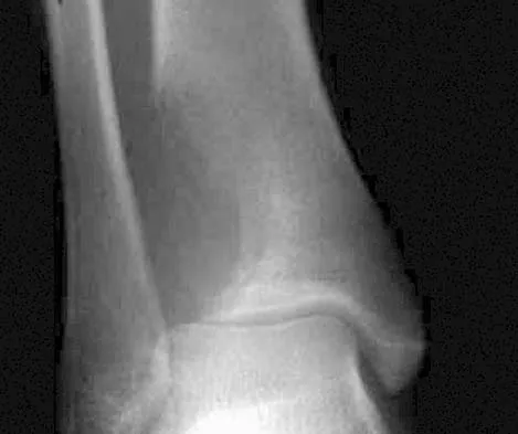 Basic Science Board Review 2005: High-Yield MCQs (Set 4) - Figure 1