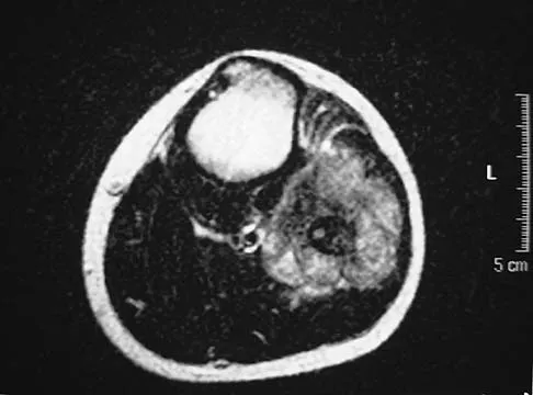 Basic Science Board Review 2005: High-Yield MCQs (Set 4) - Figure 14