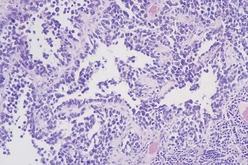 Basic Science Board Review 2005: High-Yield MCQs (Set 4) - Figure 20