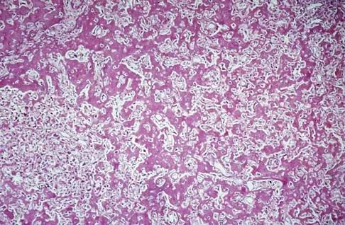 Basic Science Board Review 2005: High-Yield MCQs (Set 4) - Figure 24
