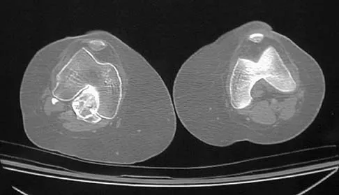 Basic Science Board Review 2005: High-Yield MCQs (Set 4) - Figure 26