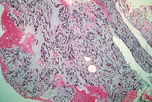 Basic Science Board Review 2005: High-Yield MCQs (Set 4) - Figure 34