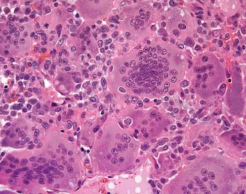 Basic Science Board Review 2005: High-Yield MCQs (Set 4) - Figure 4
