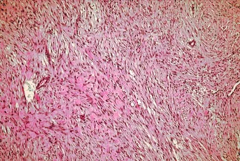 Basic Science Board Review 2005: High-Yield MCQs (Set 4) - Figure 6