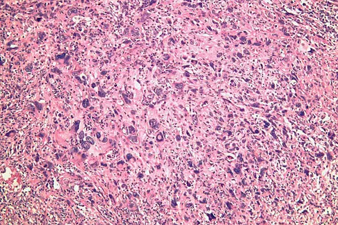 Basic Science 2008 Practice Questions: Set 1 (Solved) - Figure 13
