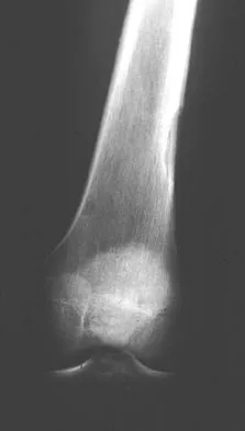 Basic Science 2008 Practice Questions: Set 1 (Solved) - Figure 14
