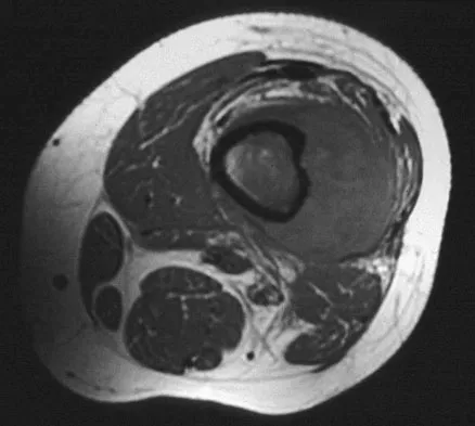Basic Science 2008 Practice Questions: Set 1 (Solved) - Figure 15