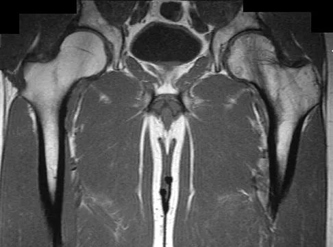 Basic Science 2008 Practice Questions: Set 1 (Solved) - Figure 21