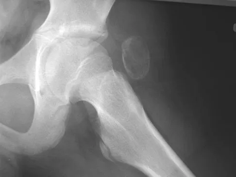 Basic Science 2008 Practice Questions: Set 1 (Solved) - Figure 27