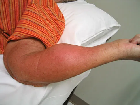 Basic Science 2008 Practice Questions: Set 1 (Solved) - Figure 28